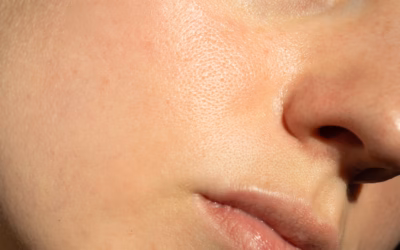 Pourquoi choisir un chirurgien de la peau au Centre Yaphé ?